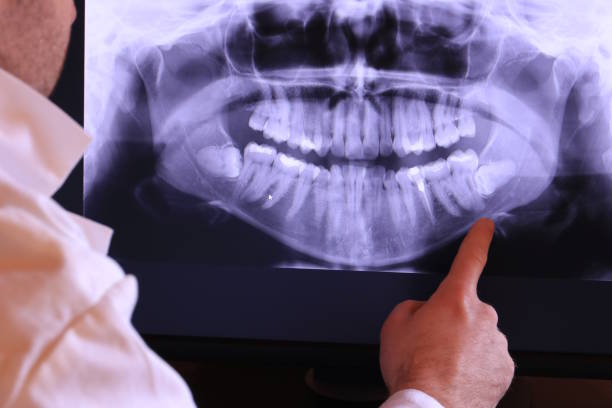 Best Emergency Tooth Extraction in Woods Cross, UT